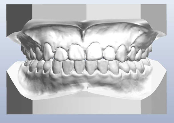 平行模型イメージ