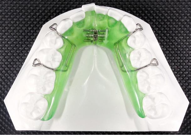 拡大床（下顎）イメージ