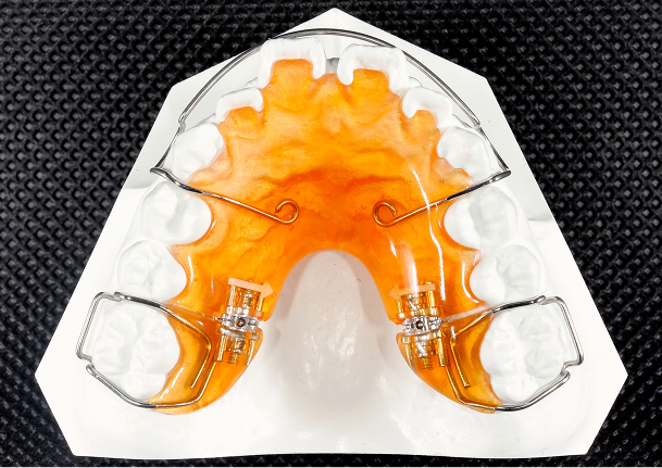 遠心拡大床イメージ