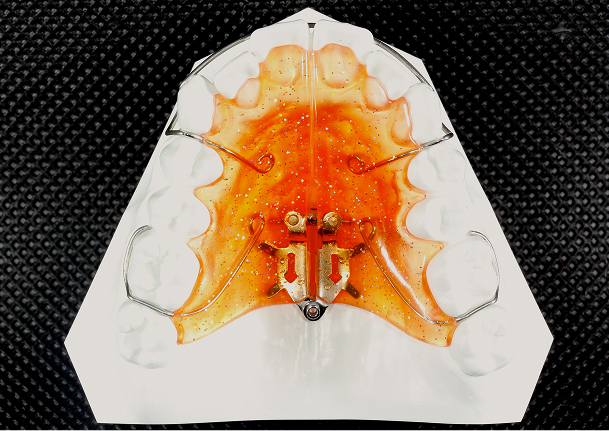 Fanタイプ拡大床
（Forestadent)イメージ