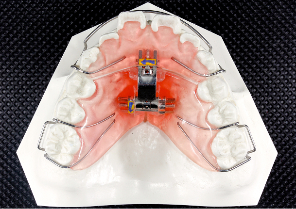 3WAY拡大床イメージ