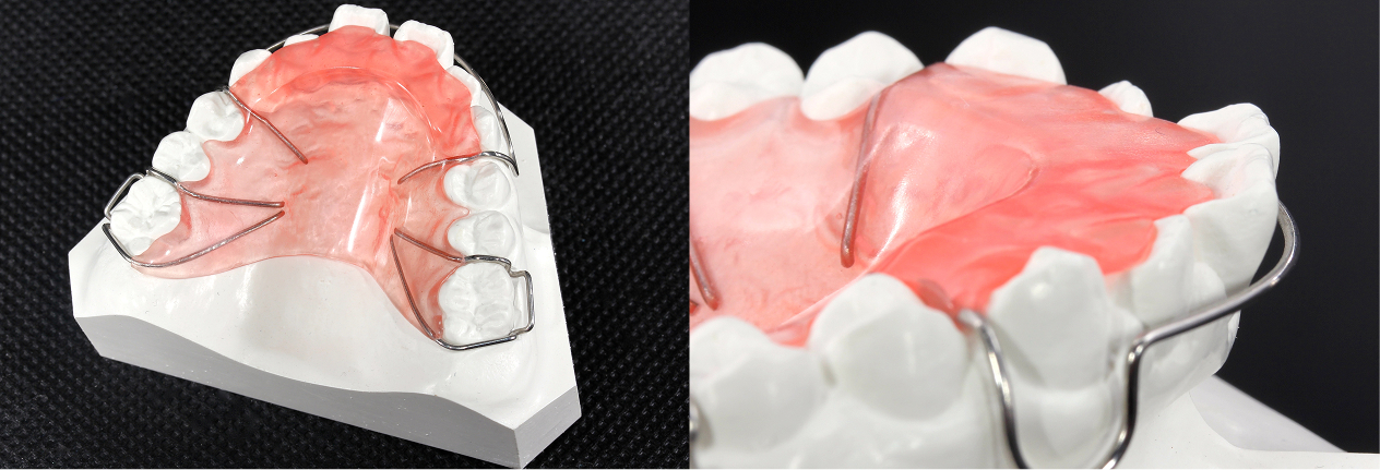 咬合挙上版イメージ