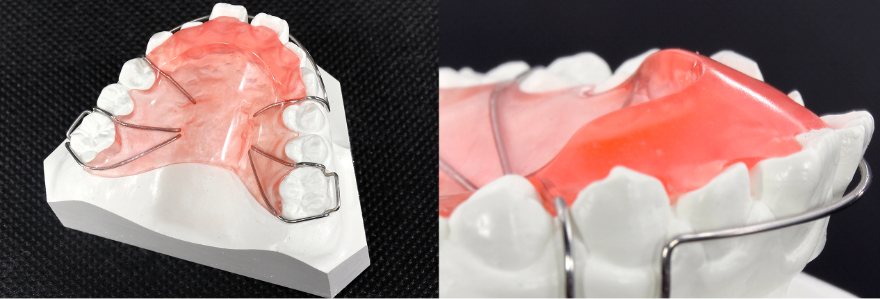 咬合斜面板イメージ