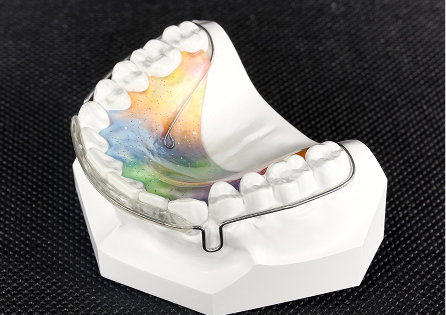 ラップアラウンドリテーナー（パッド付き）イメージ3