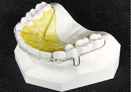 QCMリテーナー（コネクティングワイヤー）イメージ4