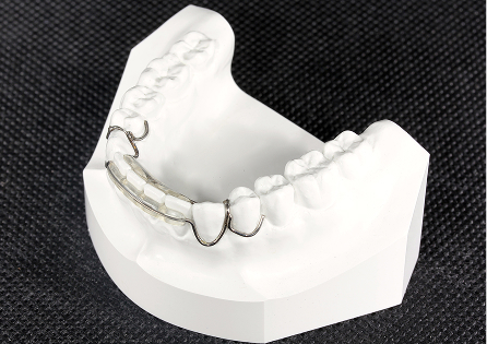 スプリングリテーナー
（４−４）イメージ4