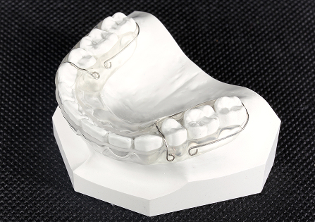 クリアリテーナーイメージ4