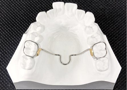 パラタルバーイメージ