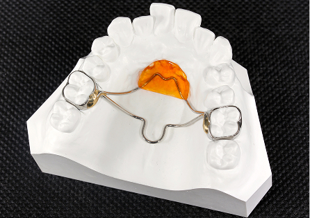 ナンス＋パラタルバーイメージ