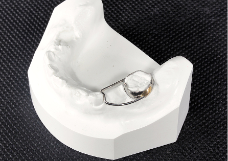 バンドループイメージ