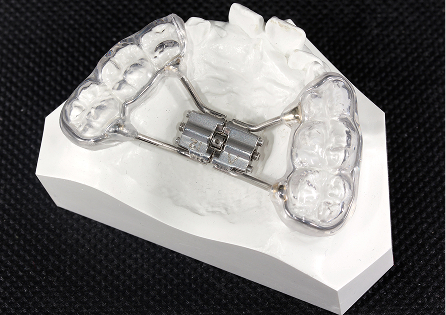 RPE（Mc Namara)イメージ